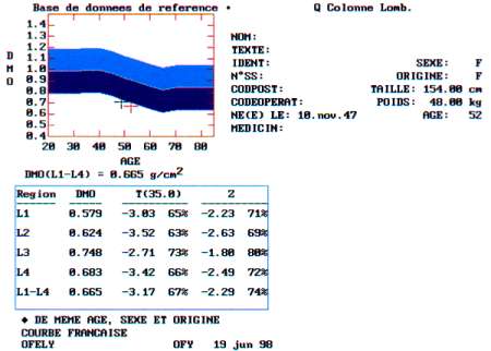 La dtermination du Z et du T score sur les vertbres lombaires